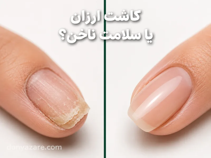 خطرات کاشت ناخن ارزان و بی کیفیت
