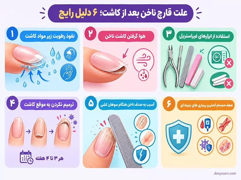 علت قارچ ناخن بعد از کاشت