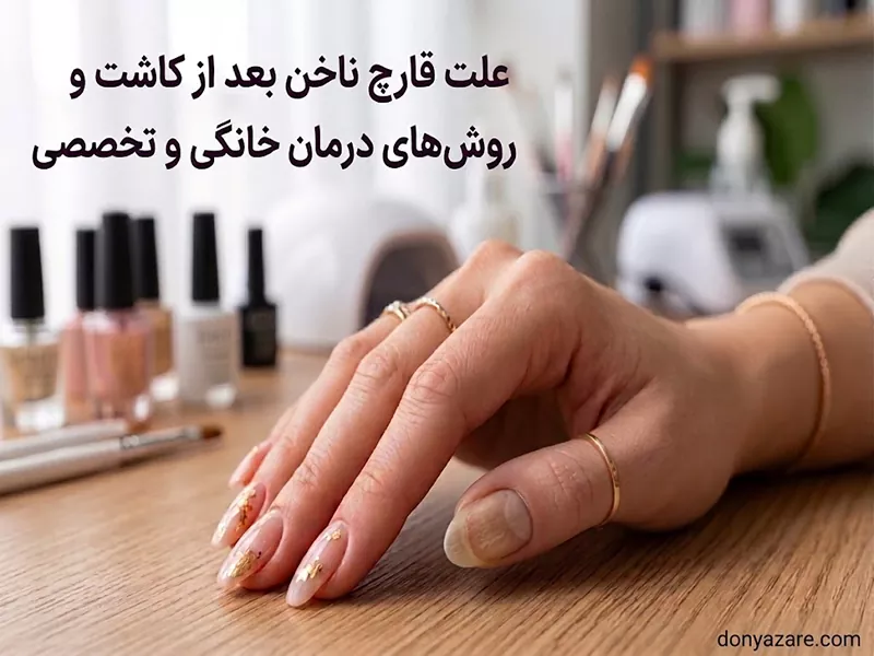 قارچ گرفتن ناخن کاشت شده