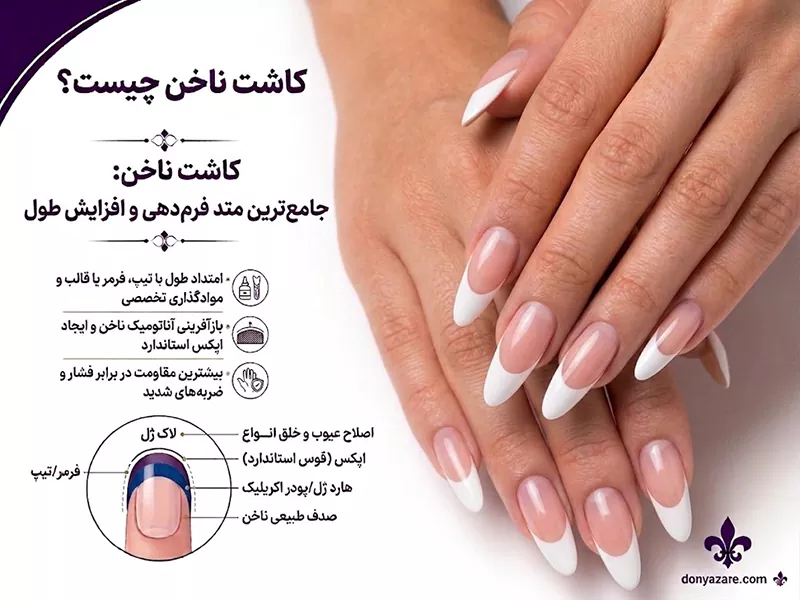 کاشت ناخن چیست؟